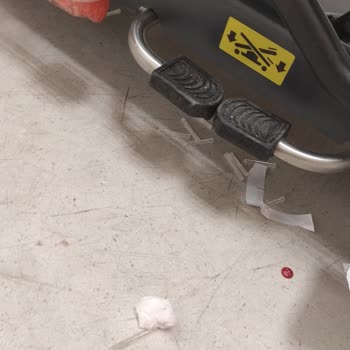 Hastane Hijyen Sorunu Ve Yetersiz Tedavi Deneyimi