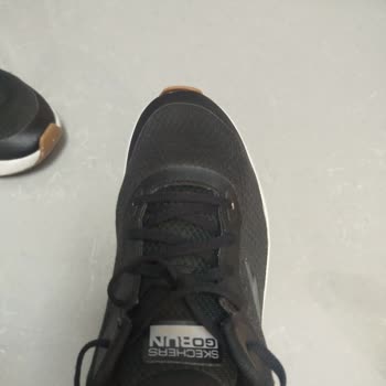 Ayakkabı Dışa Basma Sorunumu Artırdı Mağaza Çözüm Sunmadı