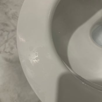 Yeni Aldığım Evdeki Klozet Kapağı Ve Müşteri Hizmetleri Sorunu