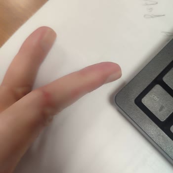 Mintax Lavabo Açıcı Patlaması Sonucu Ciddi Hasar Ve Kimyasal Yanık