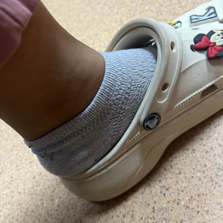 Crocs Terliğim Sıcakta Küçüldü, Mağduriyetimin Giderilmesini İstiyorum