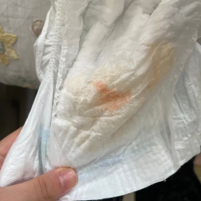 Molfix Premium Bebek Bezinde Kötü Koku Ve Renk Değişimi Endişesi