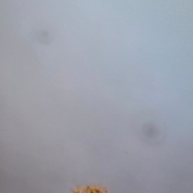 Garanti Bitmeden Oluşan Ekran Lekesine Servisten Çözüm Yok