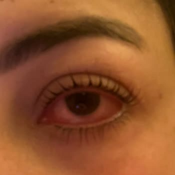 Neslim Güngen Güzellik Göz Sağlığımı Tehlikeye Atan Kirpik Lifting İşlemi Ve Sorumluluk Reddi