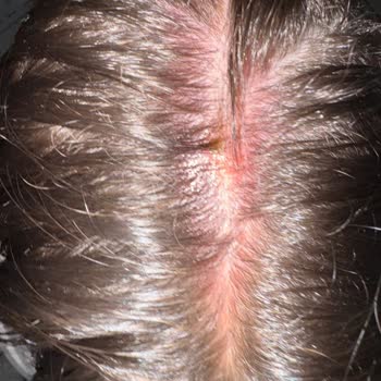 Otelin Havuz Ve Yemek Hizmetlerinde Yaşanan Sorunlar