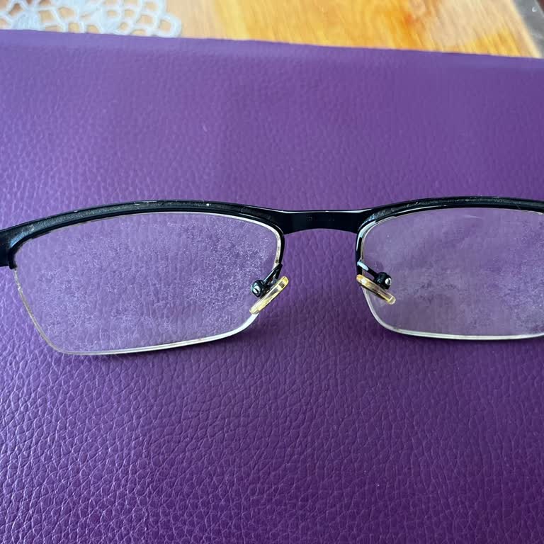 Garanti Süresinde Yanlış Bilgilendirme Ve Kalitesiz Gözlük Camı Hayal Kırıklığı