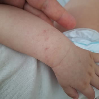 Çocuk Kan Alma Bölümünde Hemşirelerin İlgisiz Ve Agresif Davranışı Sonucu Bebeğimin Yaşadığı Olumsuz Deneyim