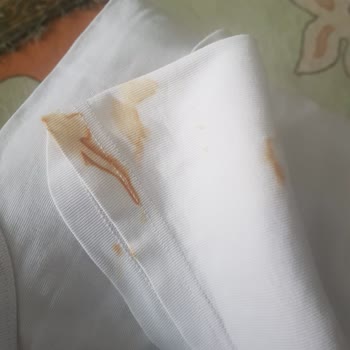 Arçelik Çamaşır Makinesi Küf Lekesi Ve Servis Sorunu