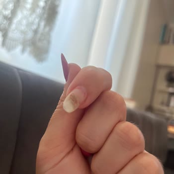 Z Nail Studio 'da Tırnağım Mantar Oldu