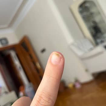 Z Nail Studio 'da Tırnağım Mantar Oldu