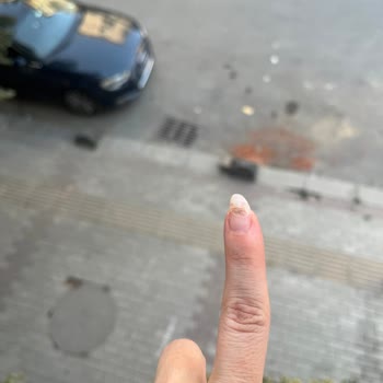 Z Nail Studio 'da Tırnağım Mantar Oldu