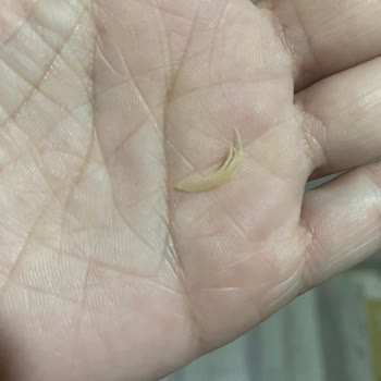 Yaşar Pastanesi Dondurmadan Çıkan Yabancı Cisim Şoku: Telafi Bekliyorum