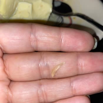 Yaşar Pastanesi Dondurmadan Çıkan Yabancı Cisim Şoku: Telafi Bekliyorum