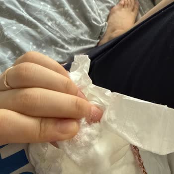 Sleepy 4 Numara Bezde Topaklanma Ve Batma Sorunu Yaşadım