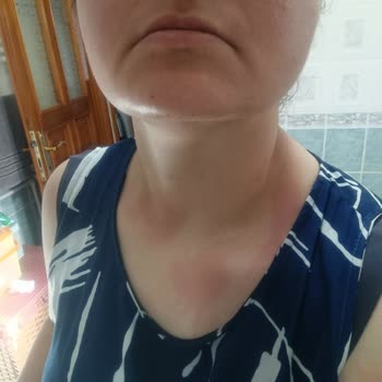 DP Şampuan Durulanmayan Sıvı Saç Kremi Boynumu Yaktı Kaşındırıyor