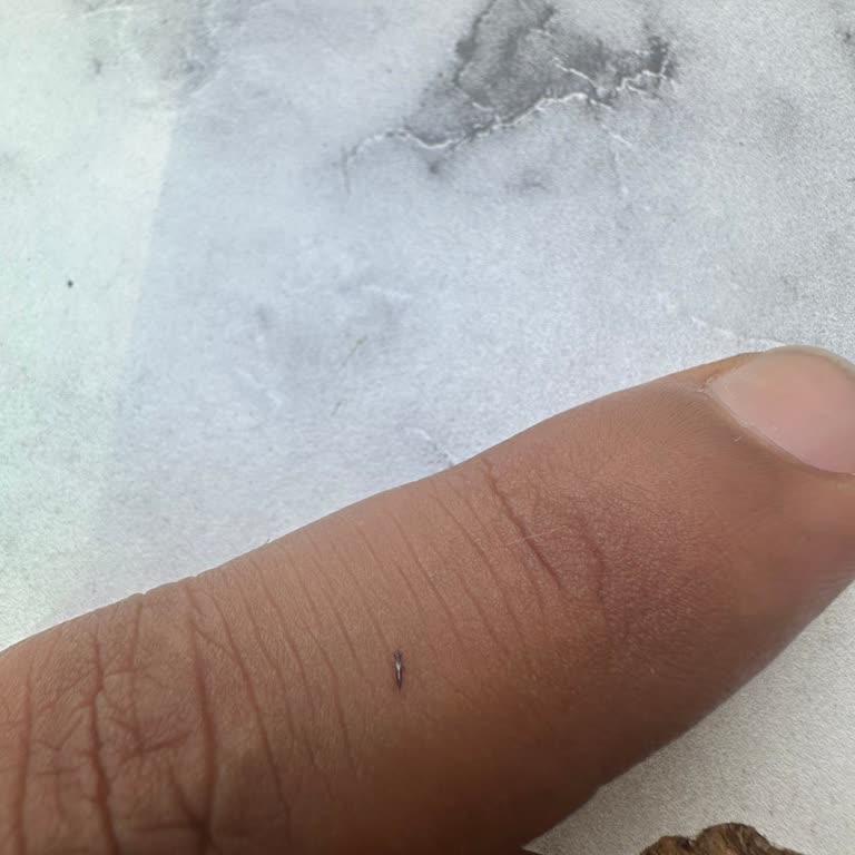 Edirne'de Böcek Ve Haşere Sorunu Yaşam Kalitemi Düşürüyor