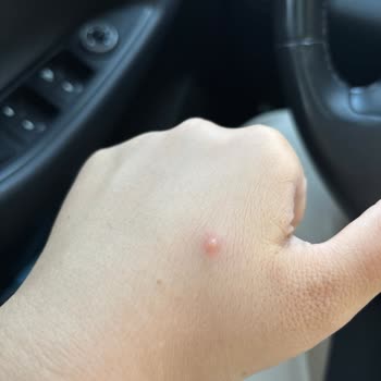 Tur Şirketinin Sözleşmeye Uymaması Ve Yetersiz Hizmet