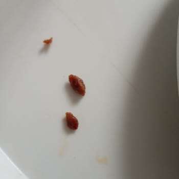 Mantı İçinden Taş Gibi Sert Madde Çıktı!