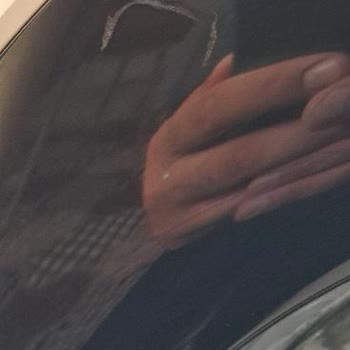 Servis Sorumsuzluğu Ve Çözülmeyen Leke Problemi