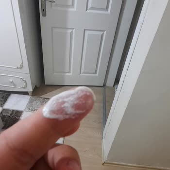 Nivea Kids Güneş Kremi Bozuk Çıktı, Kızımın Cildi Mahvoldu