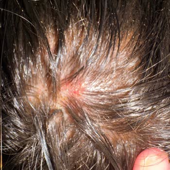 San Kuaför Hayal Kırıklığı Yaşama