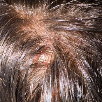 San Kuaför Hayal Kırıklığı Yaşama