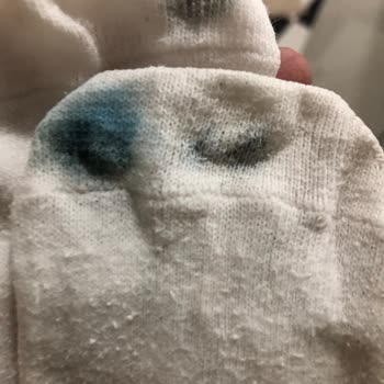 Aldığım Ayakkabıda Tekrarlayan Yırtılma Ve Renk Atma Sorunu