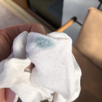 Aldığım Ayakkabıda Tekrarlayan Yırtılma Ve Renk Atma Sorunu