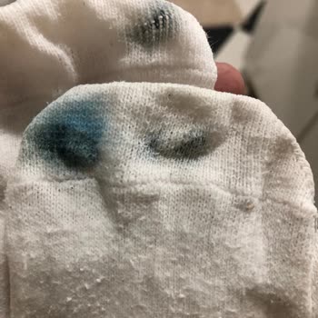 Aldığım Ayakkabıda Tekrarlayan Yırtılma Ve Renk Atma Sorunu