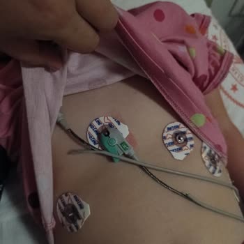Parkta Elektrik Çarpması Sonucu Yaşanan Tehlike