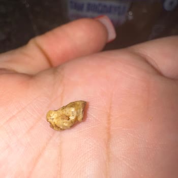 UNO Denge Ekmekten Taş Çıkması: Sağlık Ve Güven Sorunu