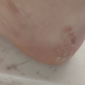 Boyner Salomon Ayakkabının Kısa Sürede Deformasyonu Ve Çözüm Bulunamaması