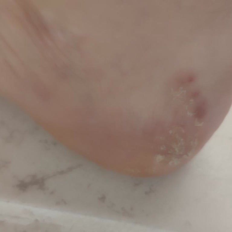 Boyner Salomon Ayakkabının Kısa Sürede Deformasyonu Ve Çözüm Bulunamaması