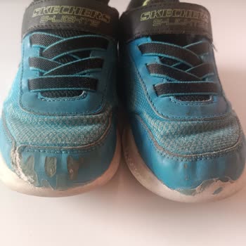 Kısa Sürede Deforme Olan Ayakkabı Ve Haksız Kullanıcı Hatası Değerlendirmesi