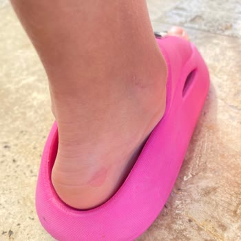 İgor Çocuk Sandaleti Ciddi Yara Ve Tahrişe Neden Oldu Kalite Beklentisini Karşılamadı