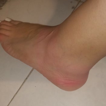 Aldığım Sandalet Ayağımı Boyadı, İade Kabul Edilmedi