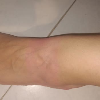 Aldığım Sandalet Ayağımı Boyadı, İade Kabul Edilmedi