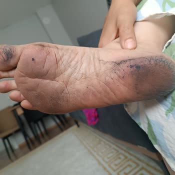 Polaris Siyah Sandaletin Ayağımda Renk Bırakması Büyük Hayal Kırıklığı Yaşattı