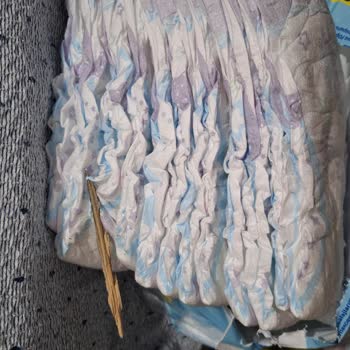 Bebek Bezi İçinden Çıkan Yabancı Madde Sağlık Riski Oluşturuyor