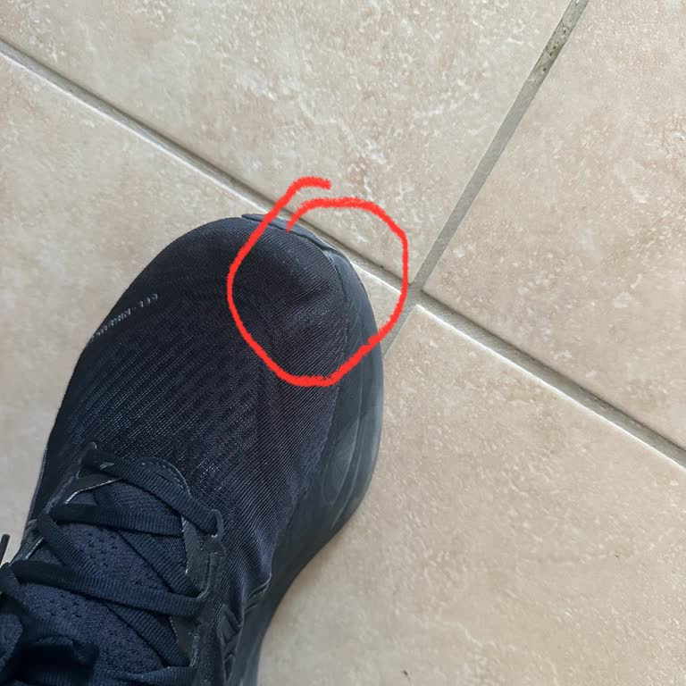 I Face Toe Injury and Defect on My Asics Gel Nimbus 27 But Got Rejected for Return
