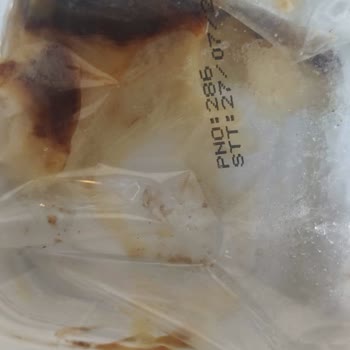 Şok Marketten Tarihi Geçmiş Ürün Sonrası Yaşadığım Sağlık Sorunu