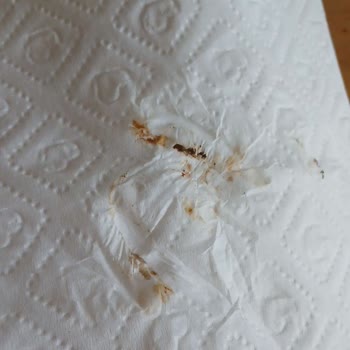 Gazlı İçecek Kapaklarında Hijyen ve Sağlık Riski Şikayeti