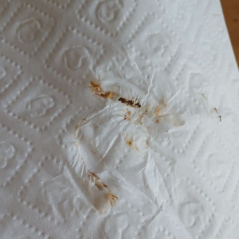 Gazlı İçecek Kapaklarında Hijyen ve Sağlık Riski Şikayeti