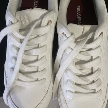 İlk Giyişte Yara Yapan Ayakkabı Ve Mağazadan İade Reddi