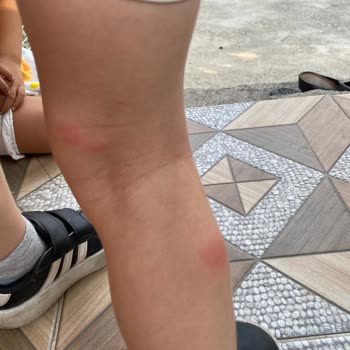 The Prouvée Réponses&nbsp;Hiçbir Koruması Yok!