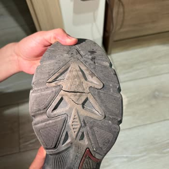 Skechers Ayakkabıda Üretim Hatası Ve Yetersiz Müşteri Hizmeti