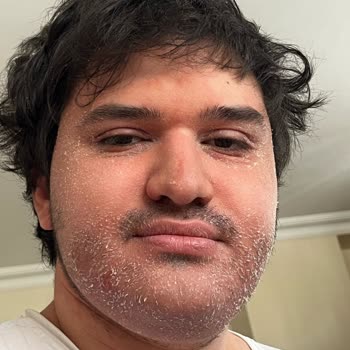 Müşteri Hizmetlerinde Oyalama Ve İade Reddi Mağduriyeti