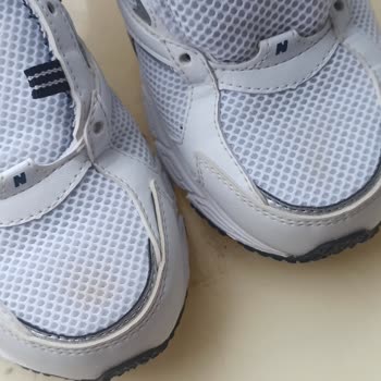 Yeni Alınan Üründe Sarı Lekeler Ve Mağduriyet