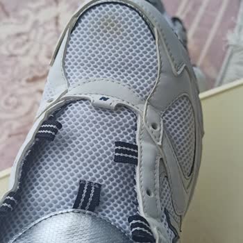 Yeni Alınan Üründe Sarı Lekeler Ve Mağduriyet