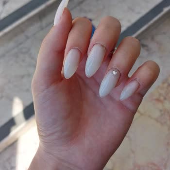 Tırnak Uygulaması Sonrası Sağlık Sorunu Ve Yetersiz Telafi